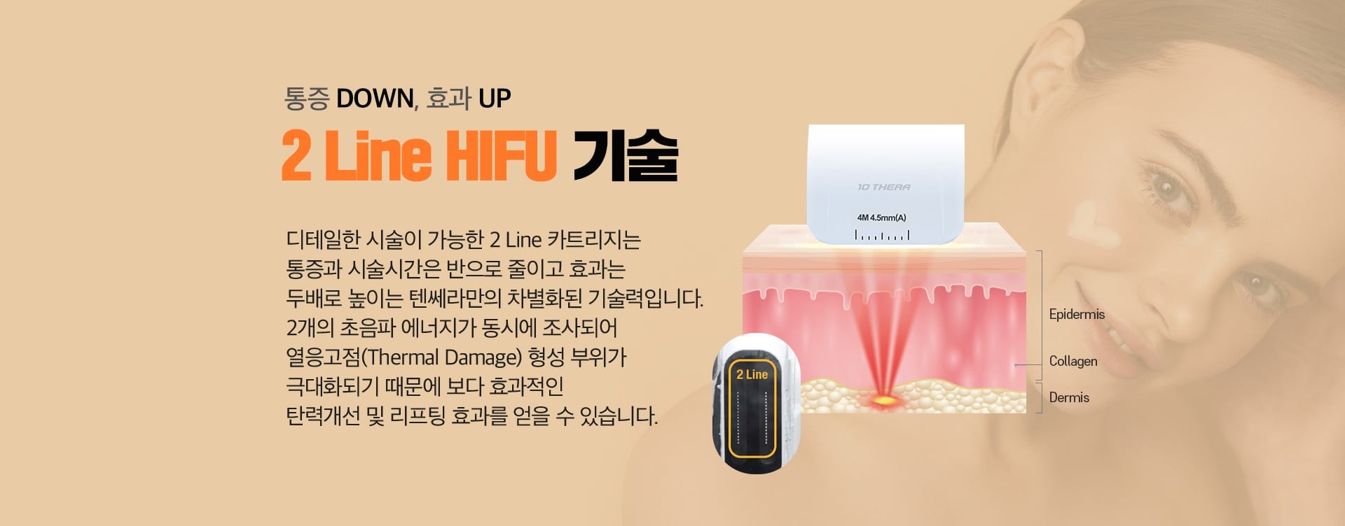 텐쎄라 통증 DOWN, 효과 UP 2Line HIFU 기술 노원피부과 닥터에버스 8756fef59dde